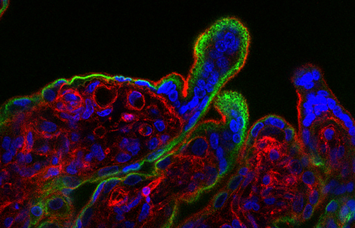 Creditos: L. Yockey et al./Science Immunology 2018/Dr. Carolyn Coyne