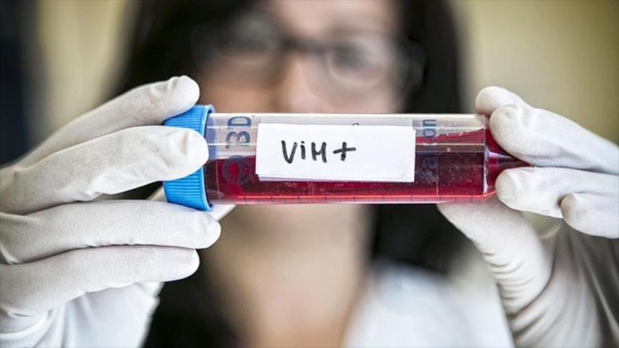 Nueva cura contra el virus del VIH