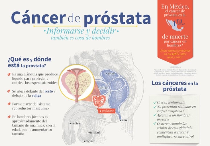cancer de prostata que es)