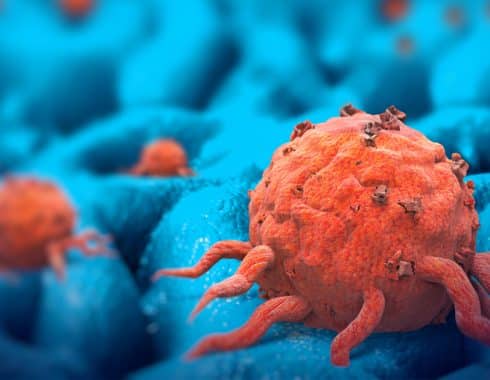 ¿Tener cáncer es igual a desarrollar un tumor?