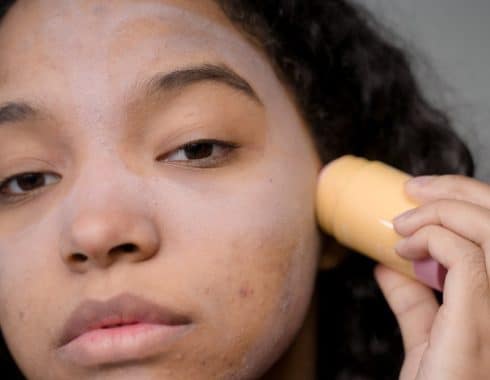 Cómo evitar el acné